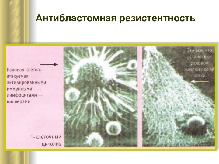 Антибластомная резистентность