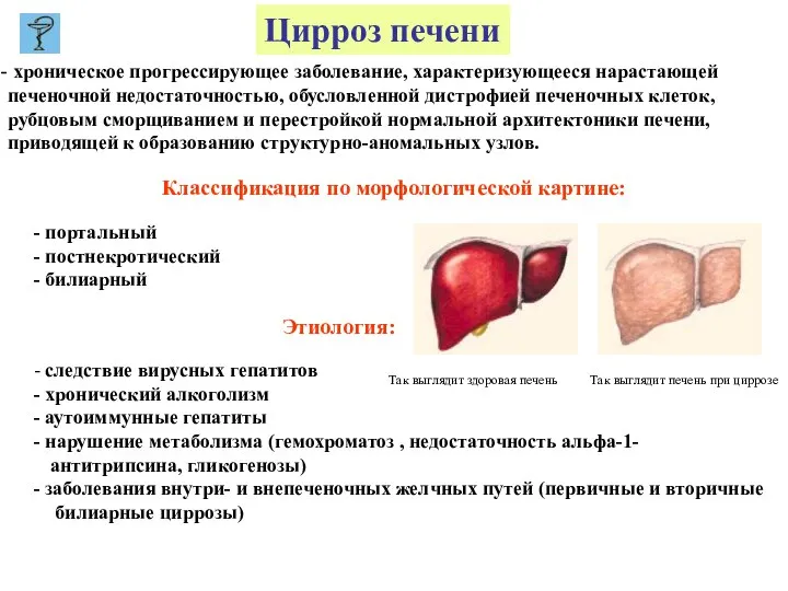 Цирроз печени хроническое прогрессирующее заболевание, характеризующееся нарастающей печеночной недостаточностью, обусловленной дистрофией