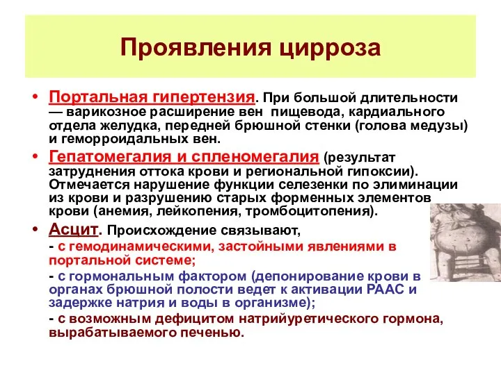 Проявления цирроза Портальная гипертензия. При большой длительности — варикозное расширение вен