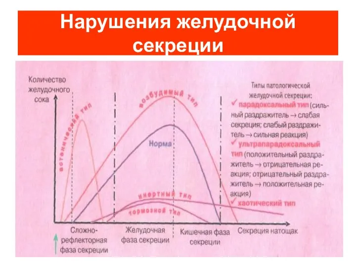 Нарушения желудочной секреции