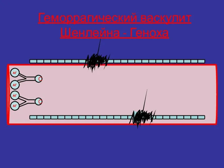 С АГ АГ С АГ АГ Геморрагический васкулит Шенлейна - Геноха