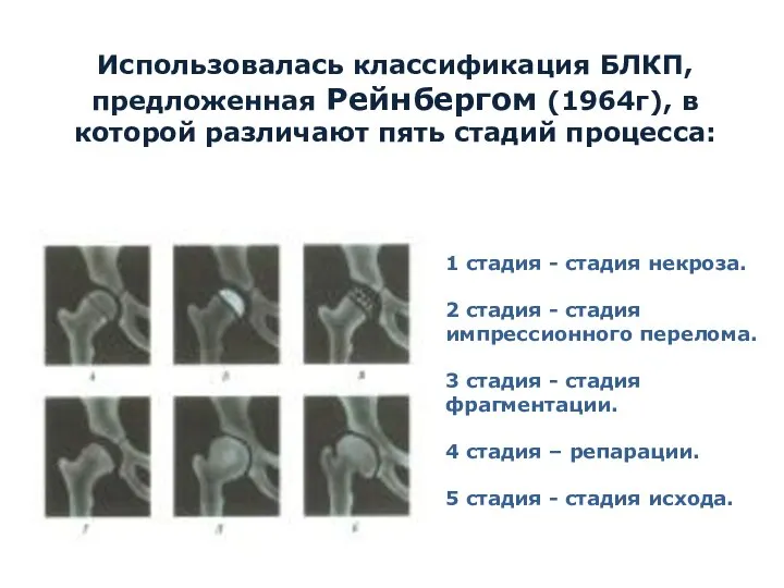 Использовалась классификация БЛКП, предложенная Рейнбергом (1964г), в которой различают пять стадий