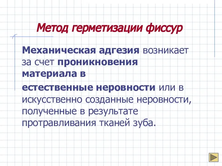 Метод герметизации фиссур Механическая адгезия возникает за счет проникновения материала в