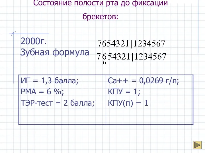 Состояние полости рта до фиксации брекетов: 2000г. Зубная формула