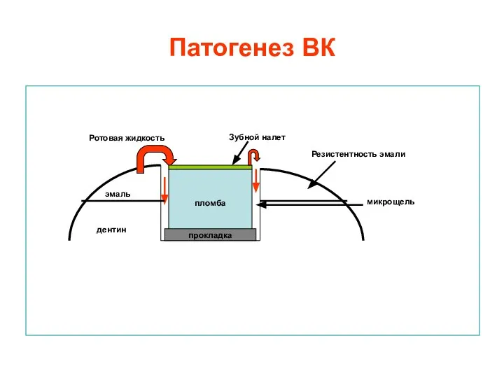 Патогенез ВК пломба прокладка Зубной налет Ротовая жидкость микрощель Резистентность эмали дентин эмаль