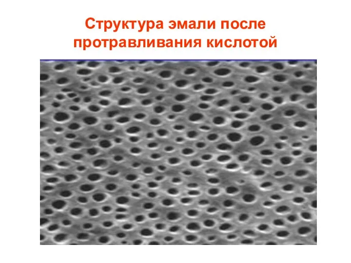Структура эмали после протравливания кислотой