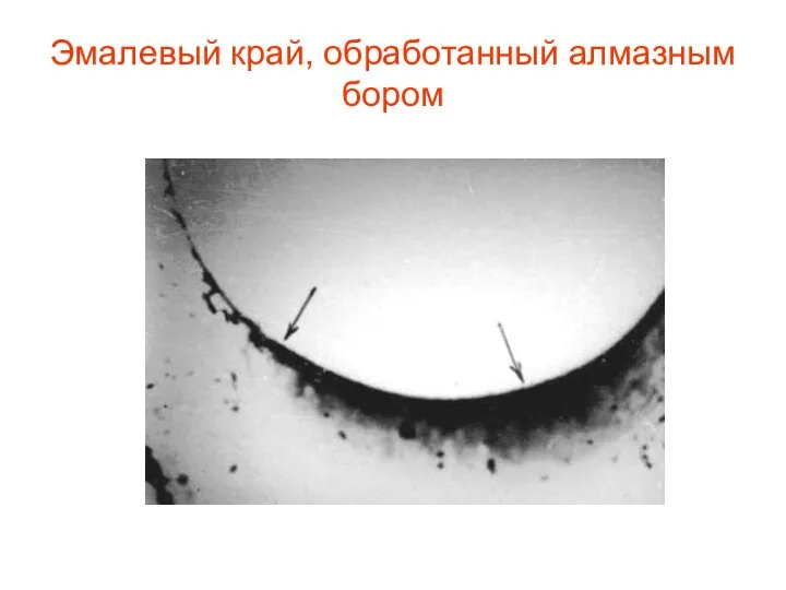 Эмалевый край, обработанный алмазным бором