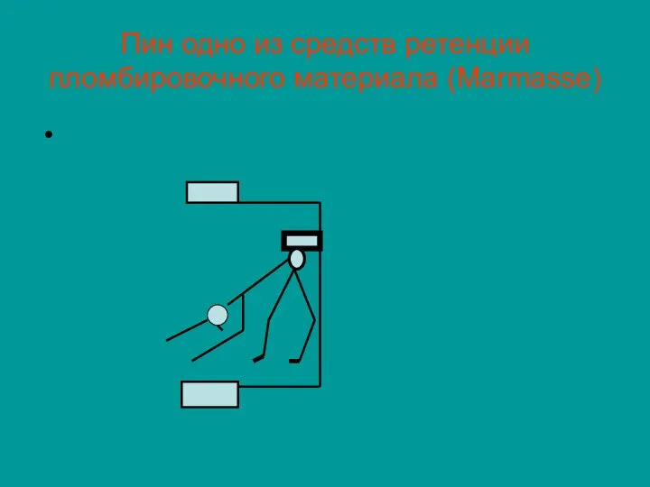 Пин одно из средств ретенции пломбировочного материала (Marmasse)