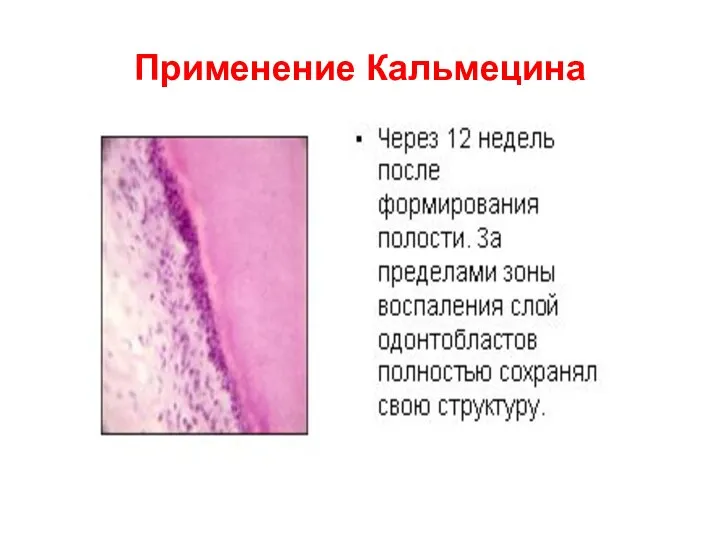 Применение Кальмецина