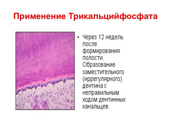 Применение Трикальцийфосфата