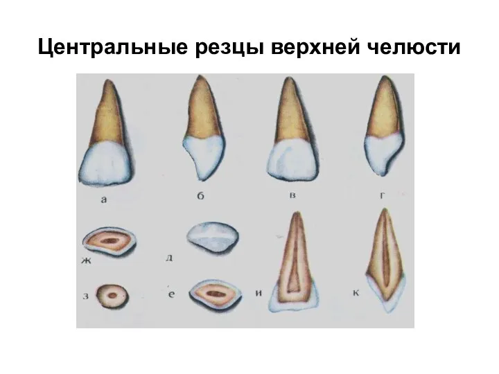 Центральные резцы верхней челюсти