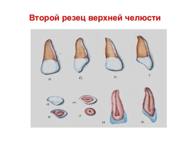 Второй резец верхней челюсти