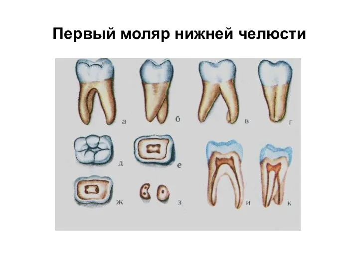 Первый моляр нижней челюсти