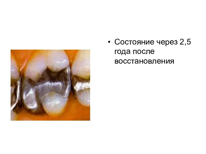 Состояние через 2,5 года после восстановления