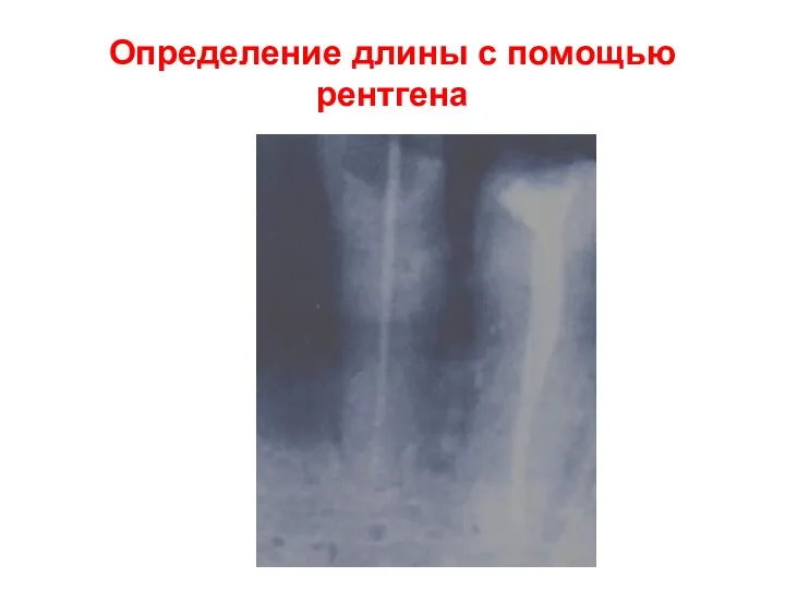 Определение длины с помощью рентгена