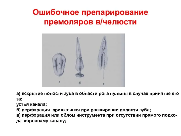 Ошибочное препарирование премоляров в/челюсти а) вскрытие полости зуба в области рога