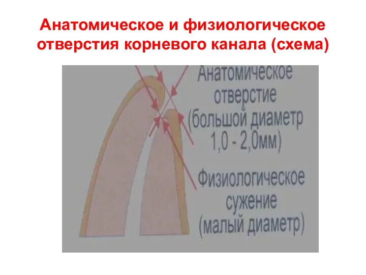 Анатомическое и физиологическое отверстия корневого канала (схема)