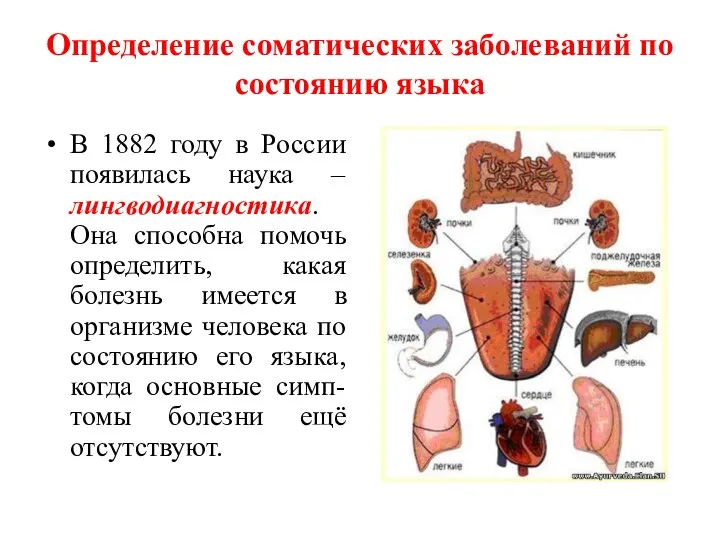 Определение соматических заболеваний по состоянию языка В 1882 году в России