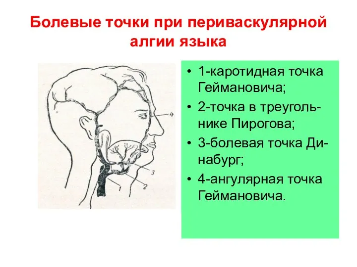 Болевые точки при периваскулярной алгии языка 1-каротидная точка Геймановича; 2-точка в