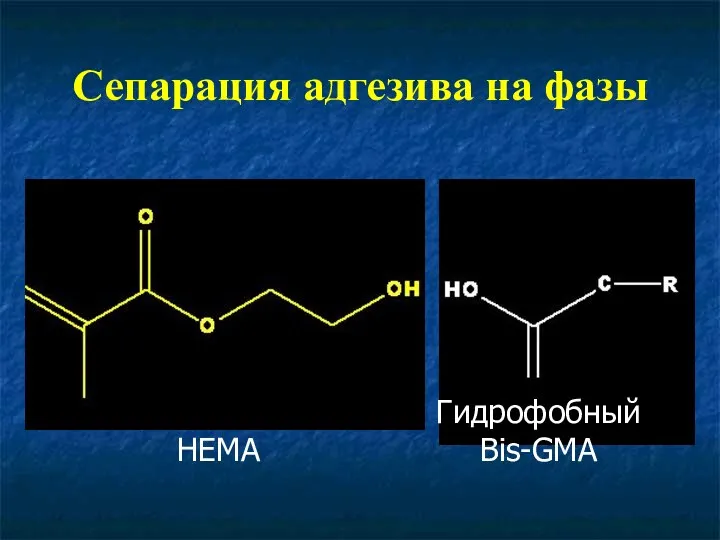 Сепарация адгезива на фазы Гидрофильный HEMA Гидрофобный Bis-GMA