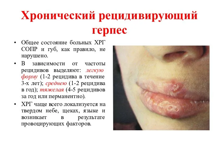 Хронический рецидивирующий герпес Общее состояние больных ХРГ СОПР и губ, как