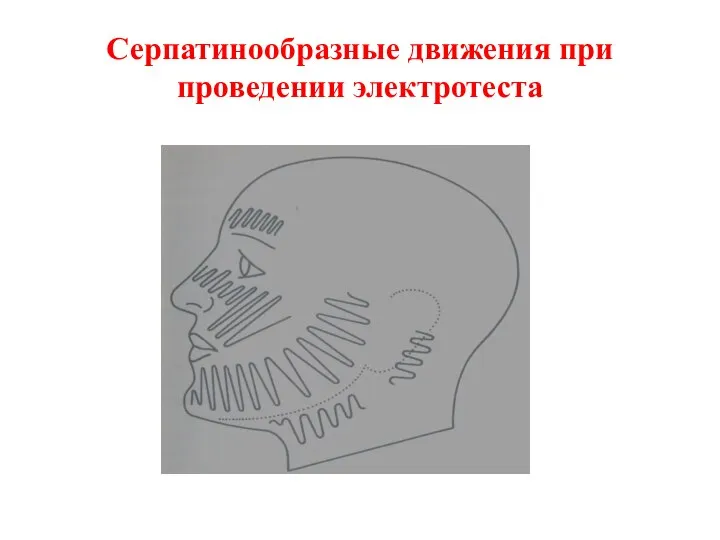 Серпатинообразные движения при проведении электротеста