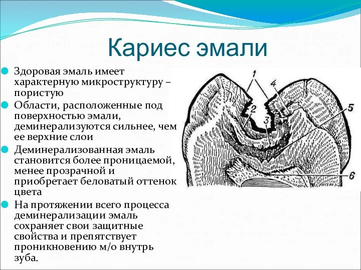 Кариес эмали Здоровая эмаль имеет характерную микроструктуру – пористую Области, расположенные