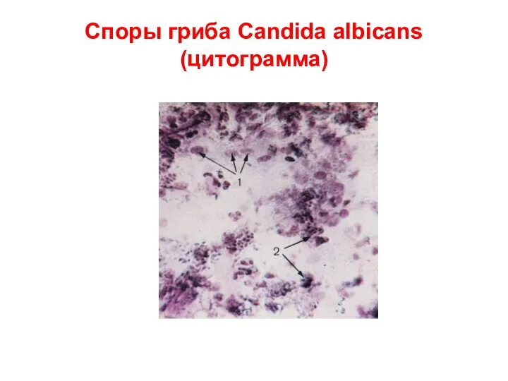 Споры гриба Candida albicans (цитограмма)