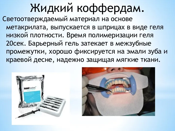 Светоотверждаемый материал на основе метакрилата, выпускается в шприцах в виде геля