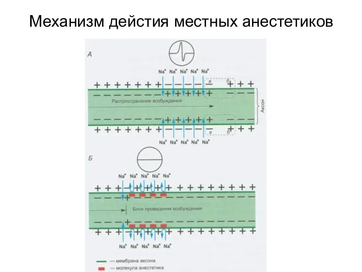 Механизм дейстия местных анестетиков