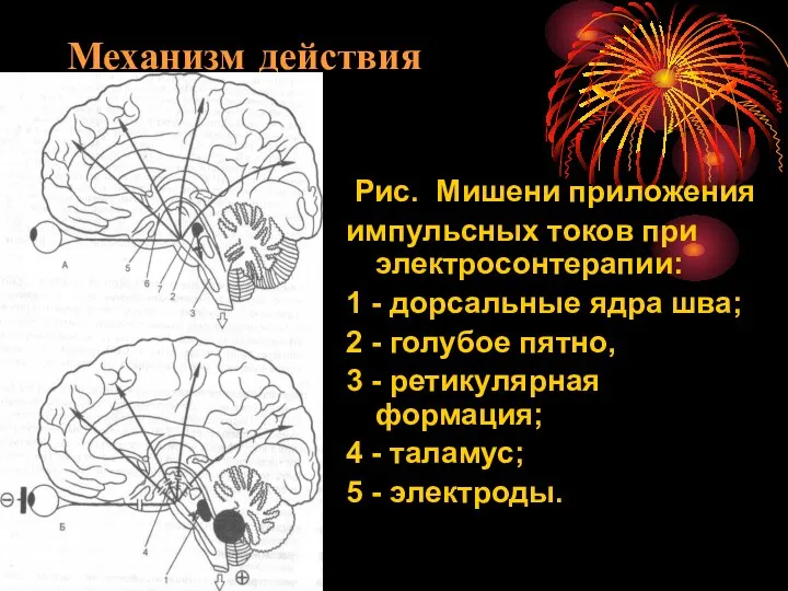 Механизм действия Рис. Мишени приложения импульсных токов при электросонтерапии: 1 -