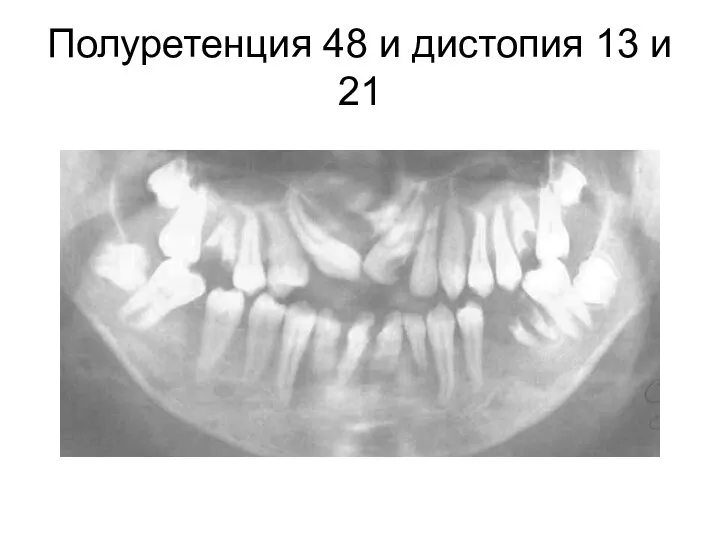 Полуретенция 48 и дистопия 13 и 21