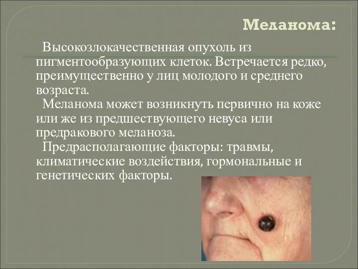 Меланома: Высокозлокачественная опухоль из пигментообразующих клеток. Встречается редко, преимущественно у лиц