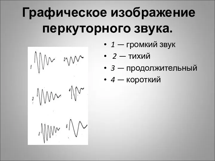 Графическое изображение перкуторного звука. 1 — громкий звук 2 — тихий