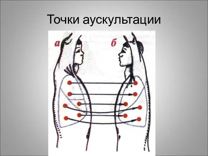 Точки аускультации