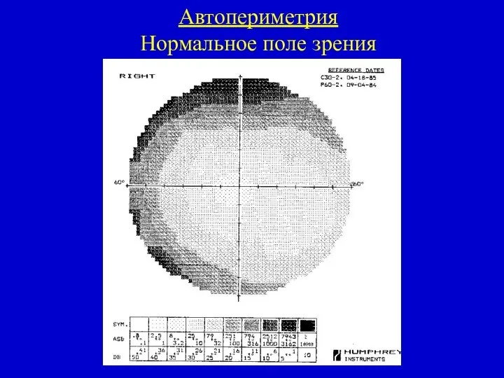 Автопериметрия Нормальное поле зрения