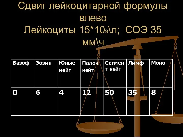 Сдвиг лейкоцитарной формулы влево Лейкоциты 15*109\л; СОЭ 35 мм\ч