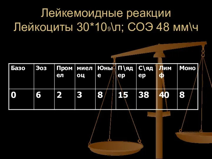 Лейкемоидные реакции Лейкоциты 30*109\л; СОЭ 48 мм\ч