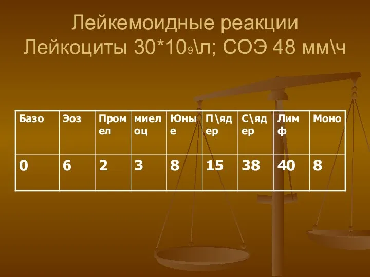 Лейкемоидные реакции Лейкоциты 30*109\л; СОЭ 48 мм\ч