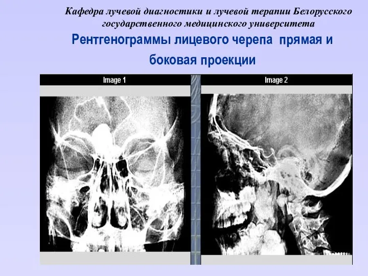 Кафедра лучевой диагностики и лучевой терапии Белорусского государственного медицинского университета Рентгенограммы
