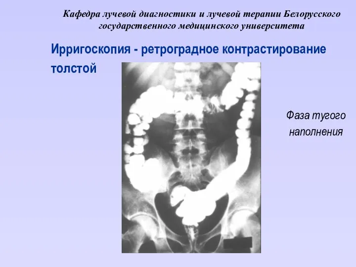 Кафедра лучевой диагностики и лучевой терапии Белорусского государственного медицинского университета Ирригоскопия