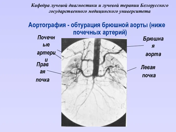 Кафедра лучевой диагностики и лучевой терапии Белорусского государственного медицинского университета Аортография