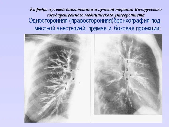 Кафедра лучевой диагностики и лучевой терапии Белорусского государственного медицинского университета Односторонняя