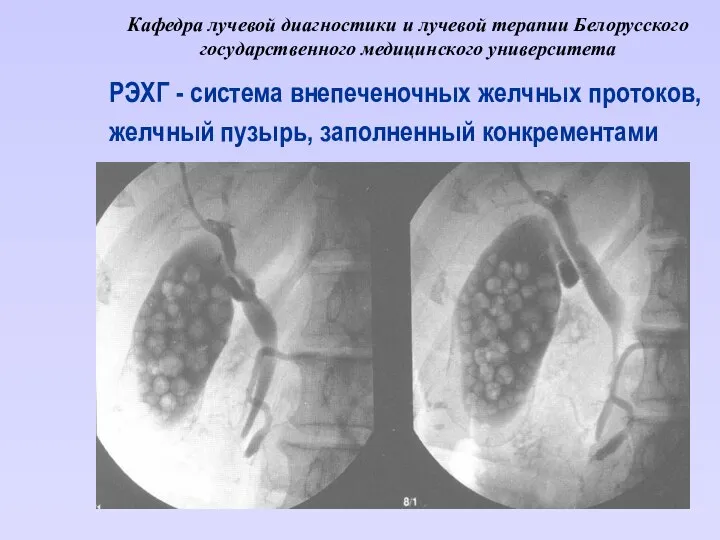 Кафедра лучевой диагностики и лучевой терапии Белорусского государственного медицинского университета РЭХГ