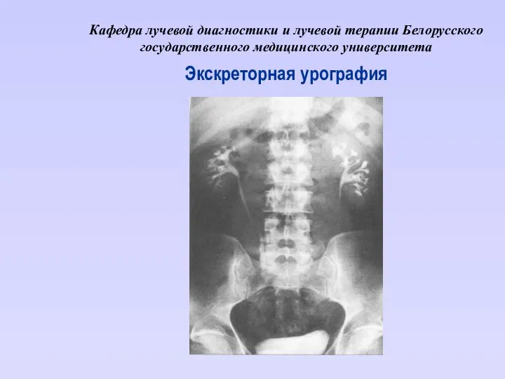 Кафедра лучевой диагностики и лучевой терапии Белорусского государственного медицинского университета Экскреторная урография