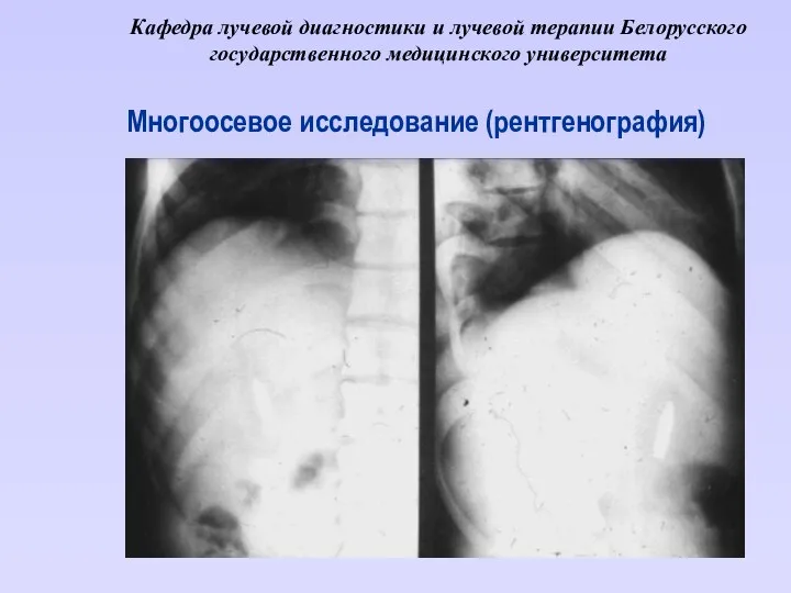 Кафедра лучевой диагностики и лучевой терапии Белорусского государственного медицинского университета Многоосевое исследование (рентгенография)