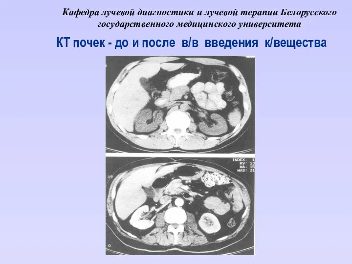 Кафедра лучевой диагностики и лучевой терапии Белорусского государственного медицинского университета КТ