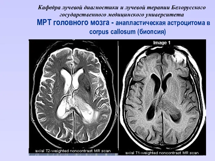 Кафедра лучевой диагностики и лучевой терапии Белорусского государственного медицинского университета МРТ