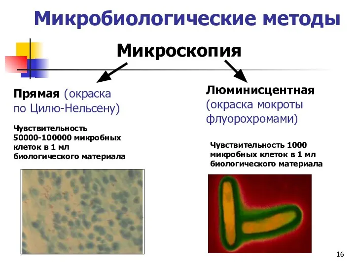 Микробиологические методы Микроскопия Прямая (окраска по Цилю-Нельсену) Чувствительность 50000-100000 микробных клеток