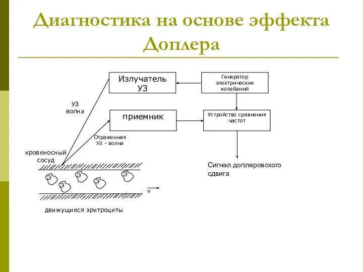 Диагностика на основе эффекта Доплера Излучатель УЗ Генератор электрических колебаний Устройство